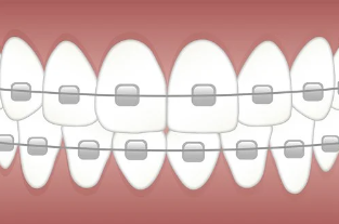 dokter orthodontist terbaik di jakarta